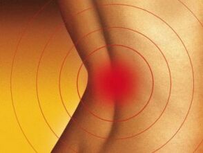 Dolor de espalda baja con osteocondrosis