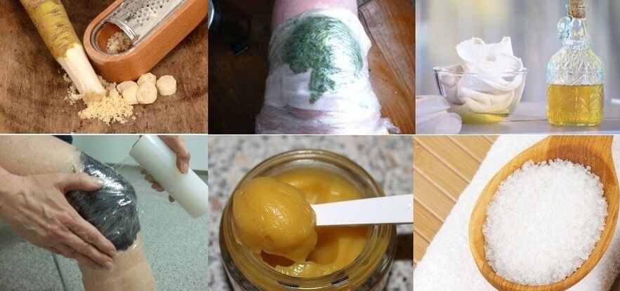 Remedios populares para el tratamiento de la artrosis de la articulación de la rodilla.