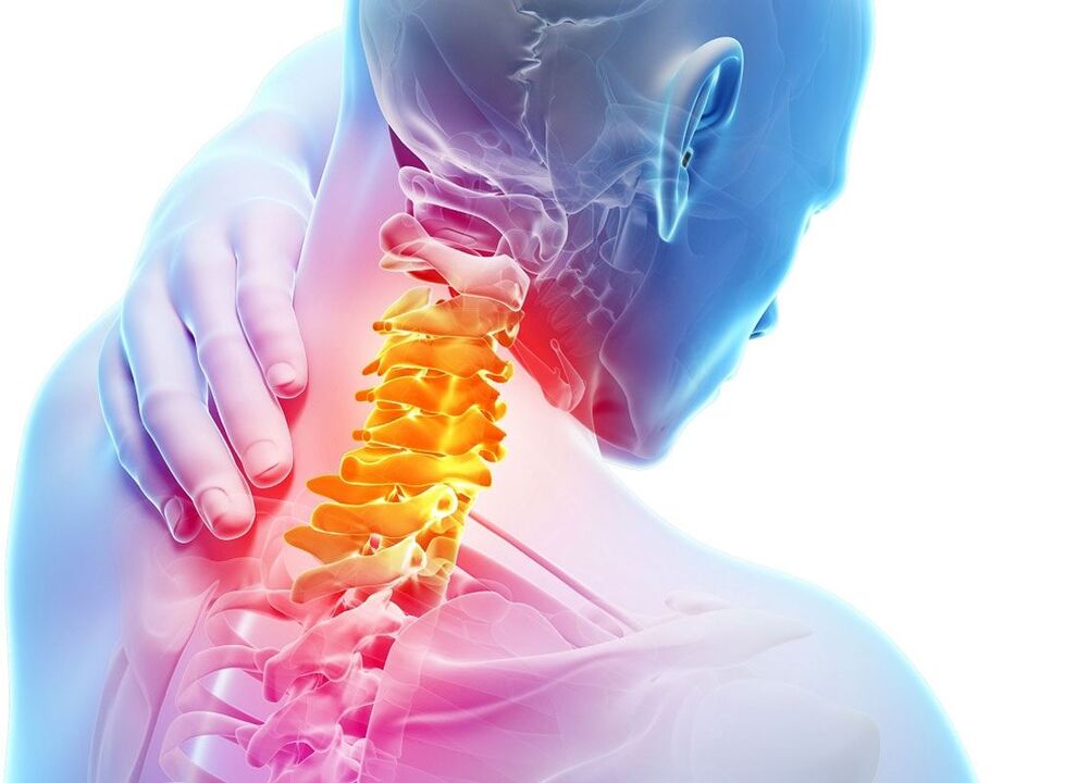 osteocondrosis de las vértebras cervicales